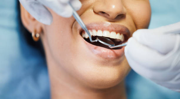 Best Broken or Cracked Tooth Emergency Dentist in Fort Recovery, OH