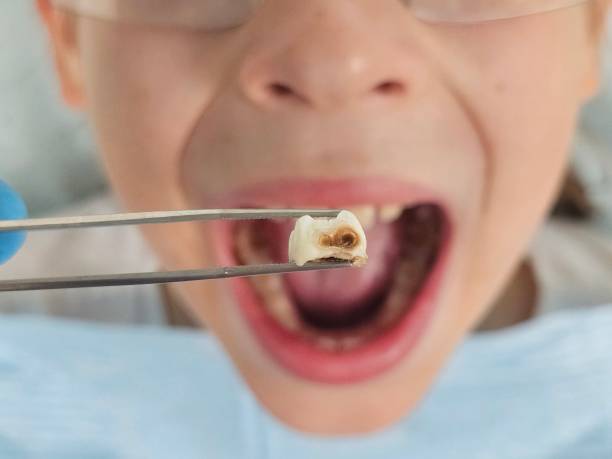 Best Pediatric Emergency Dentist in Fort Recovery, OH