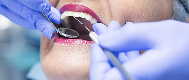 Best Emergency Root Canal Treatment in Fort Recovery, OH
