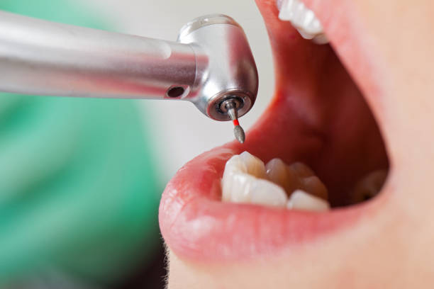 Best Mobile Emergency Dentist in Fort Recovery, OH